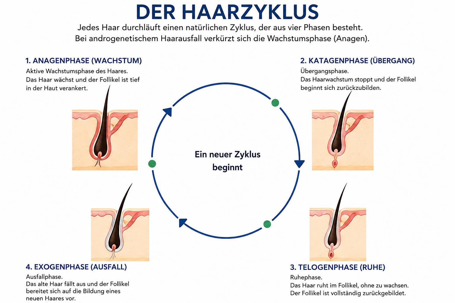 Schematische Darstellung des Haarzyklus mit Anagen Katagen Telogen und Exogenphase