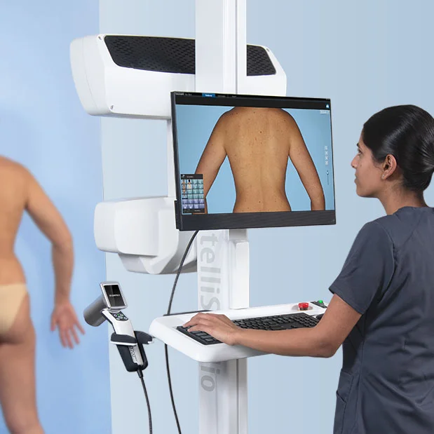 Ganzkörperaufnahme und Body Mapping zur Hautkrebsvorsorge