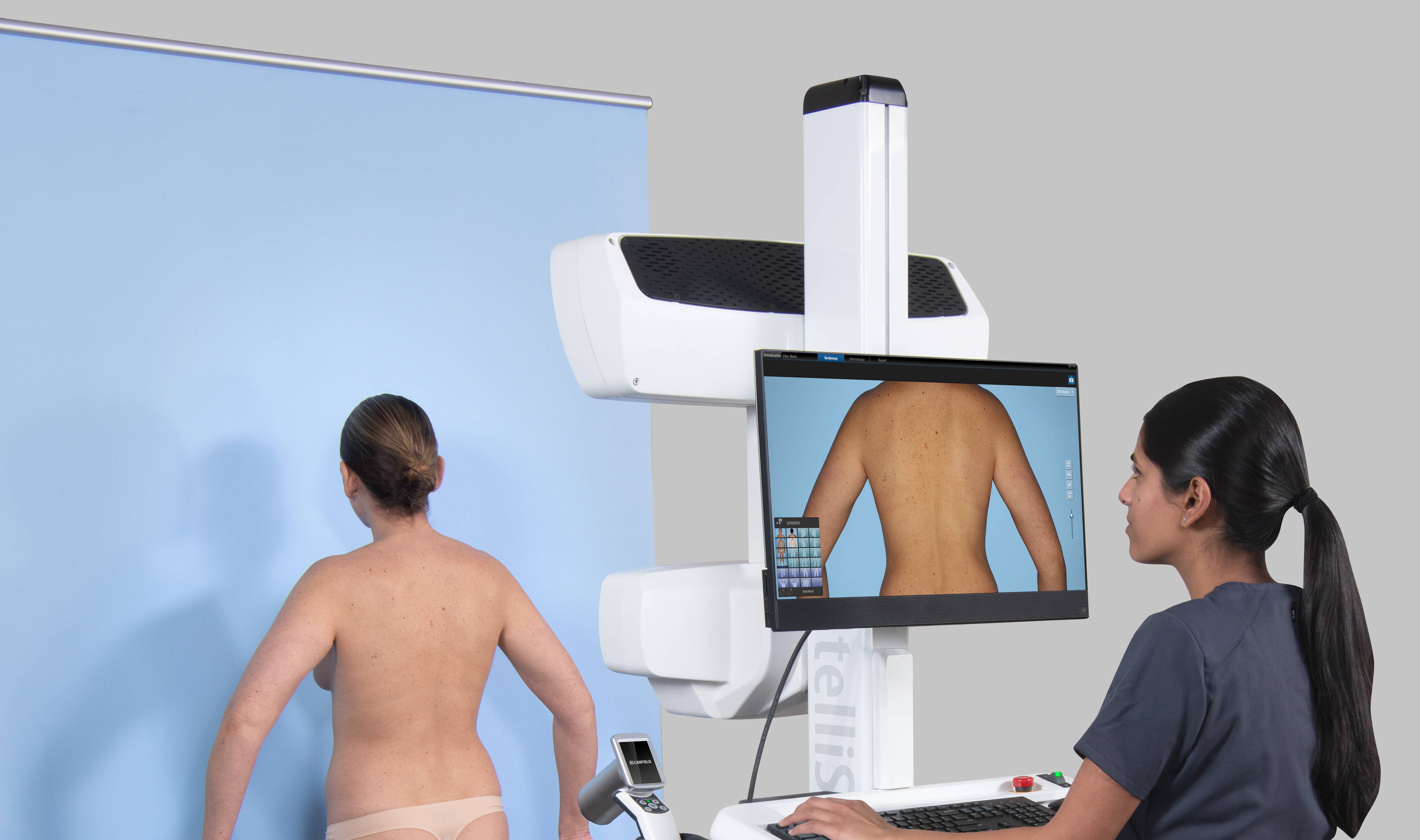 Body Mapping und Total Body Fotografie zur Hauttumorüberwachung