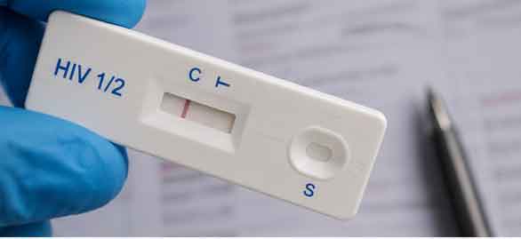 STI-Test und Behandlung sexuell übertragbarer Infektionen
