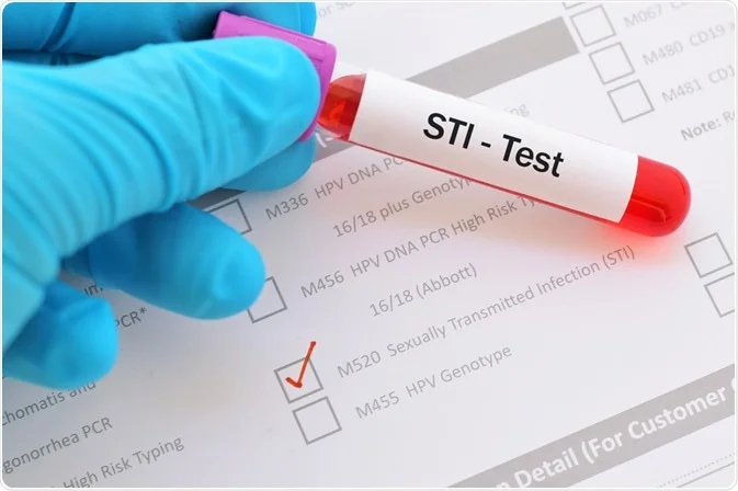 Diskrete Beratung zu HPV Impfung und sexuell übertragbaren Infektionen