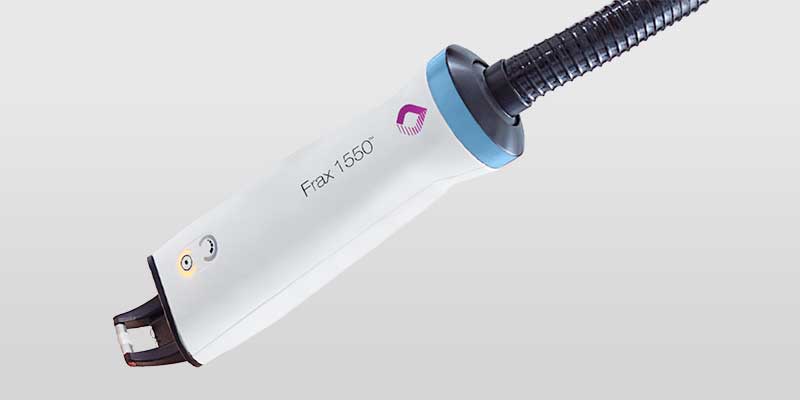 Nordlys Frax 1550 fraktionierter nicht-ablativer Laser Nordlys Frax 1550 Handstück für fraktionierte nicht-ablative Laserbehandlung