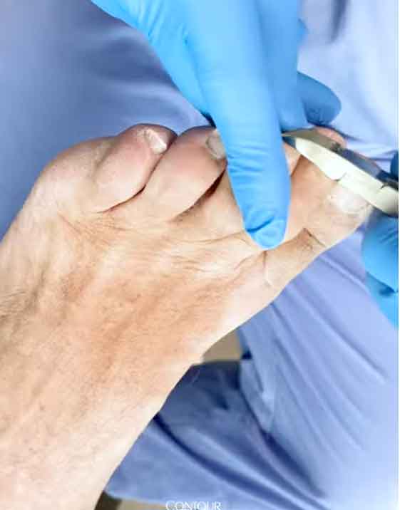 Histopathologische Spezialdiagnostik bei unklaren Nagelbefunden