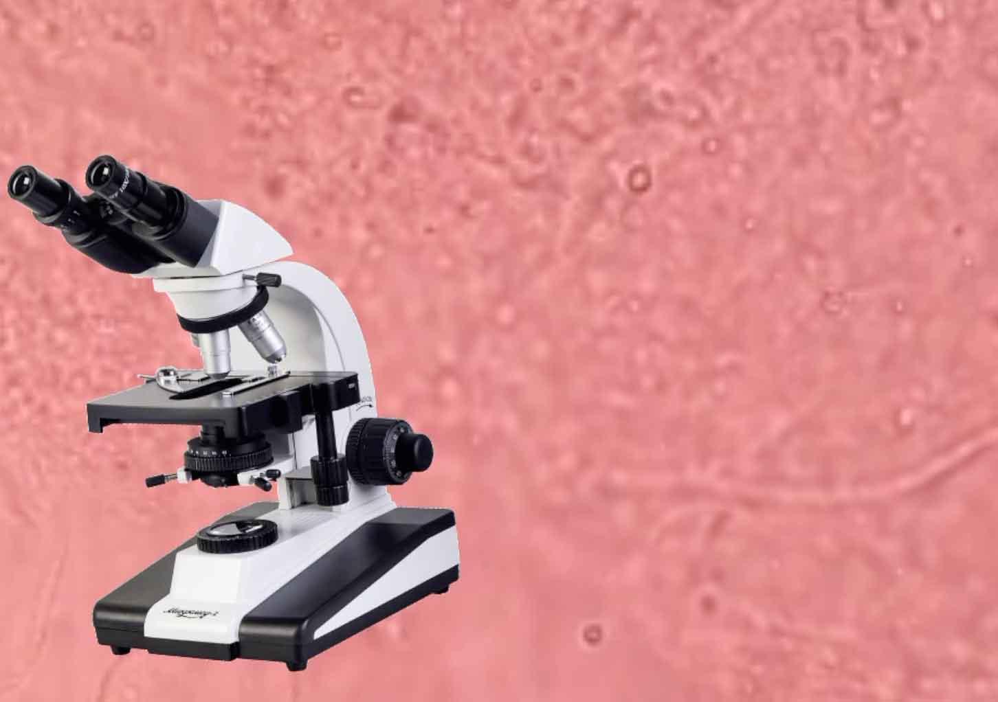 Mykologische Diagnostik bei Nagelveränderungen