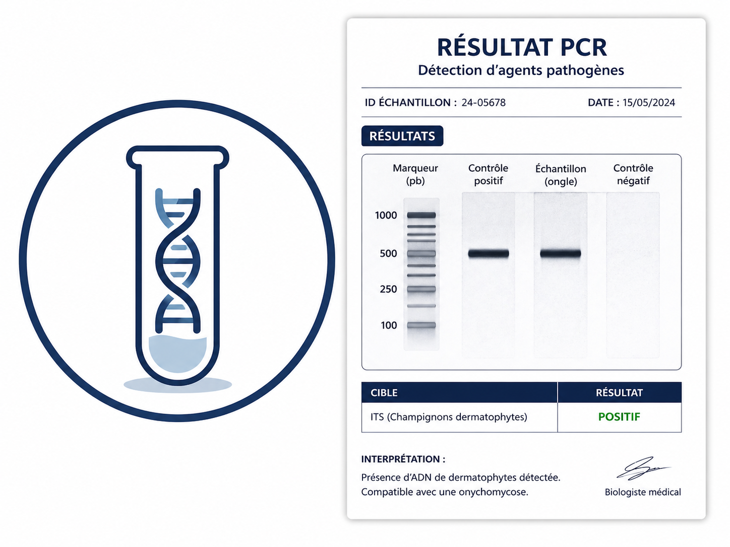 PCR und Spezialtests zum Erregernachweis bei Nagelerkrankungen