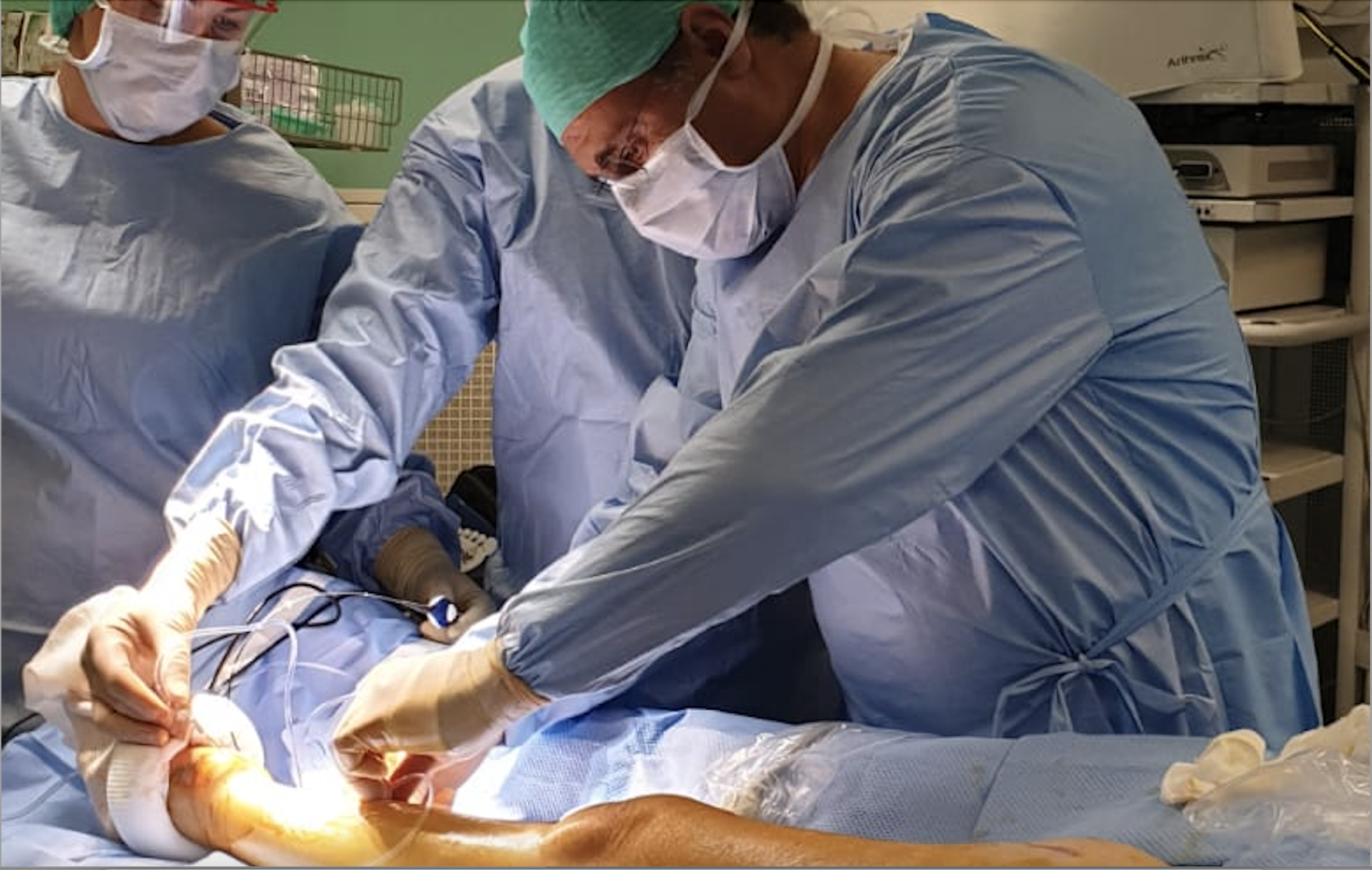 Minimalinvasive Krampfadern Behandlung im Laserzentrum Hanau