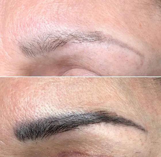 Microblading Entfernung 1